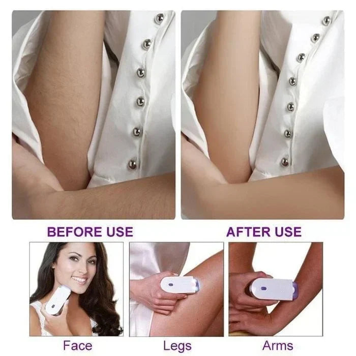 Finishing Touch Hair Epilator ๐ธ