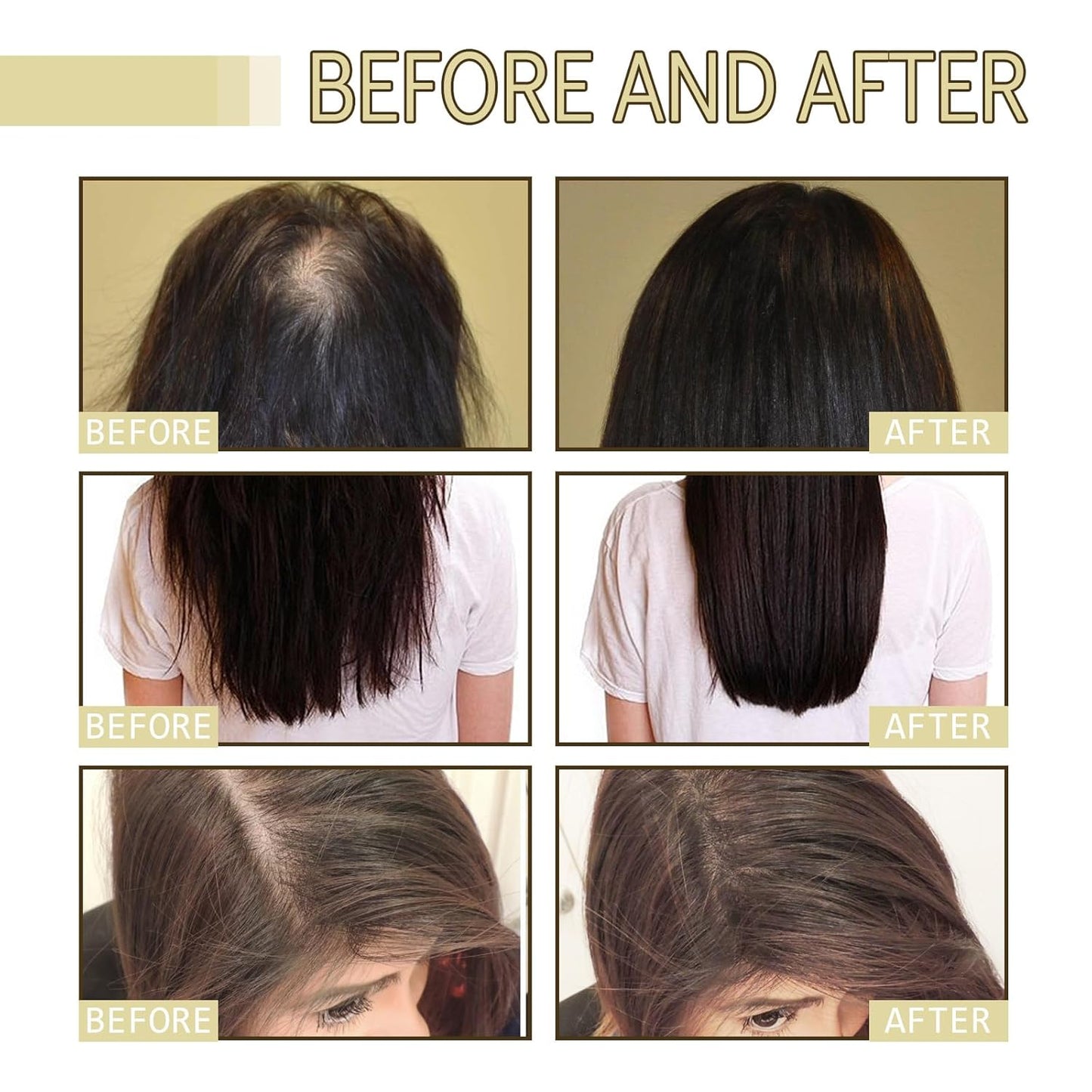 Thrive Locks™ - Hair Growth Oil
